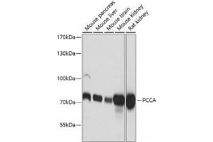 Western blot analysis of extracts of various cell lines using PCCA Polyclonal Antibody at dilution of 1:3000. (PCCA Antikörper)