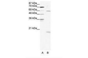 Image no. 1 for anti-SRY (Sex Determining Region Y)-Box 9 (SOX9) (AA 34-83) antibody (ABIN202687)
