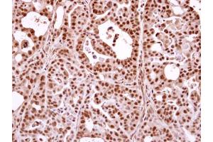 Immunohistochemistry (IHC) image for anti-THO Complex 1 (THOC1) (C-Term) antibody (ABIN2855518)