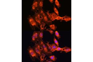 Immunofluorescence analysis of C6 cells using FSTL1 antibody (ABIN7267227) at dilution of 1:100. (FSTL1 Antikörper  (AA 1-308))