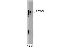 Western blot analysis of Lamp-1 on HepG2 lysate. (LAMP1 Antikörper  (AA 25-224))