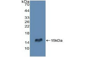 Western blot analysis of recombinant Human RIPK2. (RIPK2 Antikörper  (AA 432-540))
