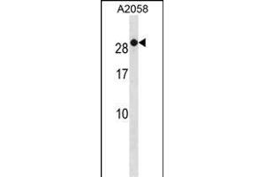 RAB7B Antibody (C-term) (ABIN1881722 and ABIN2838881) western blot analysis in  cell line lysates (35 μg/lane). (RAB7B Antikörper  (C-Term))