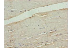 Immunohistochemistry of paraffin-embedded human skeletal muscle tissue using ABIN7175577 at dilution of 1:100 (CACNA2D1 Antikörper  (AA 577-717))