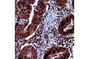 Immunohistochemical analysis of FABP2 staining in human small intestine formalin fixed paraffin embedded tissue section. (FABP2 Antikörper  (C-Term))