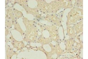 Immunohistochemistry of paraffin-embedded human kidney tissue using ABIN7148290 at dilution of 1:100 (TMEM27 Antikörper  (AA 15-141))