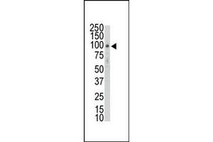 Image no. 1 for anti-Discoidin Domain Receptor tyrosine Kinase 2 (DDR2) (AA 297-327), (AA 304-320) antibody (ABIN359956)