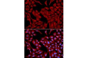 Immunofluorescence analysis of U2OS cell using DCTN2 antibody. (Dynamitin Antikörper  (AA 50-320))