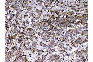 IHC analysis of Vitamin D Binding protein using anti-Vitamin D Binding protein antibody . (Gc (AA 17-256) Antikörper)