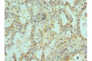 Immunohistochemistry of paraffin-embedded human lung tissue using ABIN7151217 at dilution of 1:100 (SIAH1 Antikörper  (AA 1-313))
