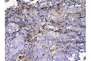 Immunohistochemistry (IHC) image for anti-Insulin-Like Growth Factor Binding Protein 2, 36kDa (IGFBP2) (AA 36-325) antibody (ABIN5519003)