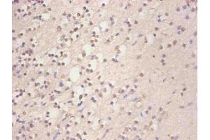 Immunohistochemical of paraffin-embedded human brain tissue using ABIN7152718 at dilution of 1:200 (FTL Antikörper)