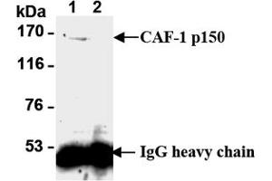 Western Blotting (WB) image for anti-Chromatin Assembly Factor 1, Subunit B (p60) (CHAF1B) antibody (ABIN1105633) (CHAF1B Antikörper)