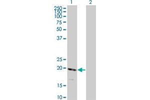 Western Blot analysis of RNF122 expression in transfected 293T cell line by RNF122 monoclonal antibody (M01), clone 5E5. (RNF122 Antikörper  (AA 61-155))