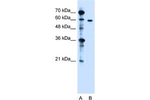 Western Blotting (WB) image for anti-Zinc Finger, DHHC-Type Containing 13 (ZDHHC13) antibody (ABIN2462814)