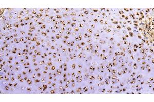 Immunohistochemistry (IHC) image for anti-Matrix Metallopeptidase 13 (Collagenase 3) (MMP13) (AA 103-290) antibody (ABIN7430978)