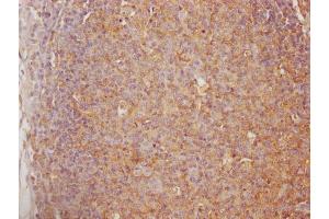 IHC image of ABIN7147565 diluted at 1:100 and staining in paraffin-embedded human lymph node tissue performed on a Leica BondTM system. (Chitotriosidase 1 Antikörper  (AA 215-430))