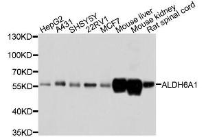 Western blot analysis of extracts of various cell lines, using ALDH6A1 antibody. (ALDH6A1 Antikörper  (AA 326-535))