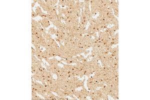 (ABIN6244226 and ABIN6577745) staining WDR82 in human brain tissue sections by Immunohistochemistry (IHC-P - paraformaldehyde-fixed, paraffin-embedded sections). (WDR82 Antikörper  (N-Term))