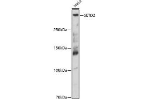 Western Blotting (WB) image for anti-SET Domain Containing 2 (SETD2) (AA 803-1103) antibody (ABIN1682666)