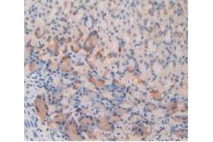 IHC-P analysis of Mouse Stomach Tissue, with DAB staining, using IL12Rb2 Antibody (20 μg/ml) and HRP-conjugated Goat Anti-Rabbit antibody (abx400043, 2 µg/ml). (IL12RB2 Antikörper  (AA 285-441))