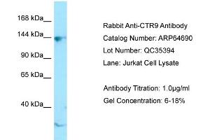 Western Blotting (WB) image for anti-RNA Polymerase-Associated Protein CTR9 Homolog (CTR9) (C-Term) antibody (ABIN2789925) (CTR9 Antikörper  (C-Term))