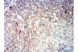 Immunohistochemistry (IHC) image for anti-BCL2-Like 10 (Apoptosis Facilitator) (BCL2L10) (AA 31-186) antibody (ABIN5611302)