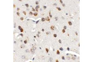 Immunohistochemical analysis of CHD7 in mouse brain tissue with CHD7 polyclonal antibody  at 5 ug/mL.
