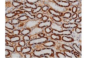 ABIN6267399 at 1/200 staining Rat kidney tissue sections by IHC-P. (CREB1 Antikörper  (pSer142))