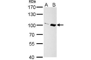WB Image Importin 13 antibody [C3], C-term detects Importin 13 protein by Western blot analysis. (IPO13 Antikörper  (C-Term))