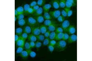 IF analysis of CaMKII alpha/CAMK2A using anti-CaMKII alpha/CAMK2A antibody (ABIN7599429).