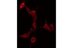 ABIN6275911 staining  HeLa cells by IF/ICC. (Serotonin Receptor 5A Antikörper  (Internal Region))