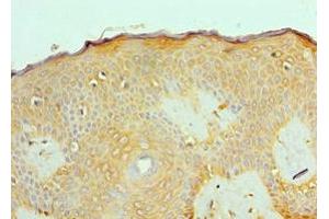 Immunohistochemistry of paraffin-embedded human skin tissue using ABIN7143180 at dilution of 1:100