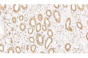 Immunohistochemistry (IHC) image for anti-Ribonucleotide Reductase M1 (RRM1) (AA 1-213) antibody (ABIN7436186)