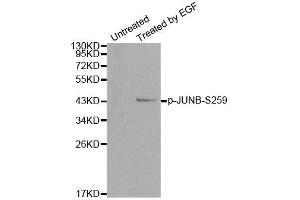 Western blot analysis of extracts from HT29 cells, using Phospho-JUNB-S259 antibody (ABIN2988088). (JunB Antikörper  (pSer259))