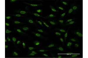 Immunofluorescence of monoclonal antibody to OXSR1 on HeLa cell. (OXSR1 Antikörper  (AA 351-450))