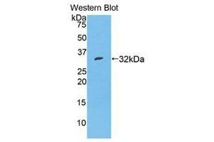 Western Blotting (WB) image for anti-Serpin Family A Member 7 (SERPINA7) (AA 127-393) antibody (ABIN1078580) (SERPINA7 Antikörper  (AA 127-393))