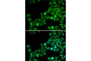 Immunofluorescence analysis of U2OS cells using POLK antibody (ABIN5973607). (POLK Antikörper)