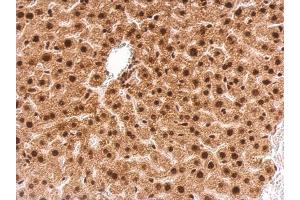Immunohistochemistry (IHC) image for anti-Growth Factor Receptor-Bound Protein 2 (GRB2) (C-Term) antibody (ABIN2854697)