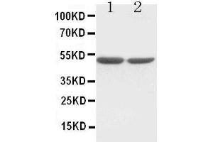 Anti-c-Fos antibody, Western blotting Lane 1:  Cell Lysate Lane 2: COLO320 Cell Lysate (c-FOS Antikörper  (Middle Region))