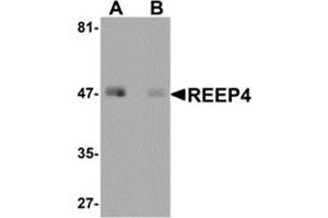 Western blot analysis of REEP4 in human lung tissue lysate with REEP4 antibody at 1 μg/ml in (A) the absence and (B) the presence of blocking peptide. (Receptor Accessory Protein 4 Antikörper  (Center))
