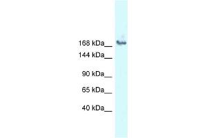 WB Suggested Anti-SNRNP200 Antibody Titration: 1. (SNRNP200 Antikörper  (N-Term))