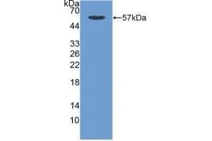 Detection of Recombinant CDHOB, Human using Polyclonal Antibody to Cadherin, Osteoblast (CDHOB) (OB Cadherin Antikörper  (AA 374-595))