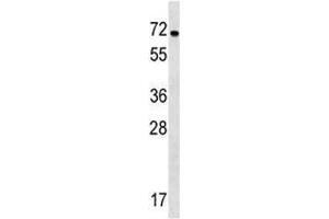 NOX1 antibody western blot analysis in WiDr lysate. (NOX1 Antikörper  (AA 243-271))