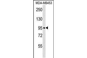 Western blot analysis in MDA-MB453 cell line lysates (35ug/lane). (FBXO11 Antikörper  (N-Term))