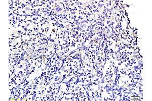 Formalin-fixed and paraffin embedded rat periodontitis tissue labeled with Anti-Wnt3a Polyclonal Antibody , Unconjugated at 1:300 followed by conjugation to the secondary antibody, (SP-0023) , and DAB staining (WNT3A Antikörper  (AA 281-352))