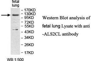 Image no. 1 for anti-ALS2 C-terminal Like (ALS2CL) antibody (ABIN1574646) (ALS2CL Antikörper)