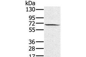 Western Blot analysis of Hela cell using HSF2 Polyclonal Antibody at dilution of 1:550 (HSF2 Antikörper)