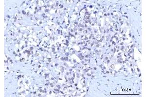 IHC analysis of RBM15B using anti-RBM15B antibody (ABIN7600219).