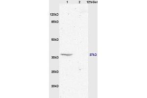 Lane 1: mouse brain lysates Lane 2: mouse embryo lysates probed with Anti GPR55 Polyclonal Antibody, Unconjugated  at 1:200 in 4˚C. (GPR55 Antikörper  (AA 141-240))